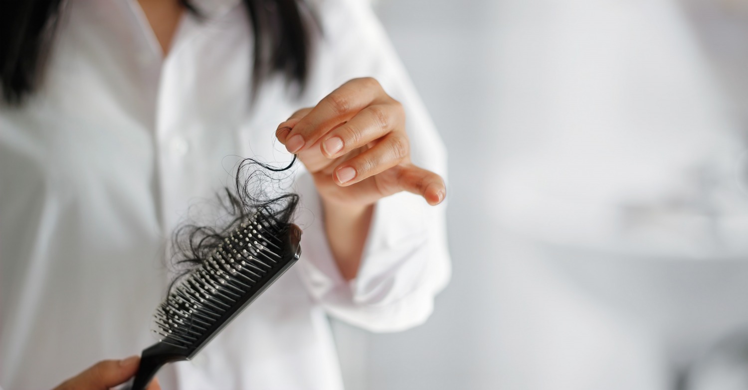 Tips on how you can avoid hair loss